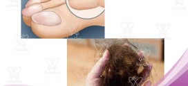 درمان بیماری های مو و ناخن