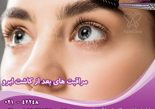 مراقبت های بعد از کاشت ابرو